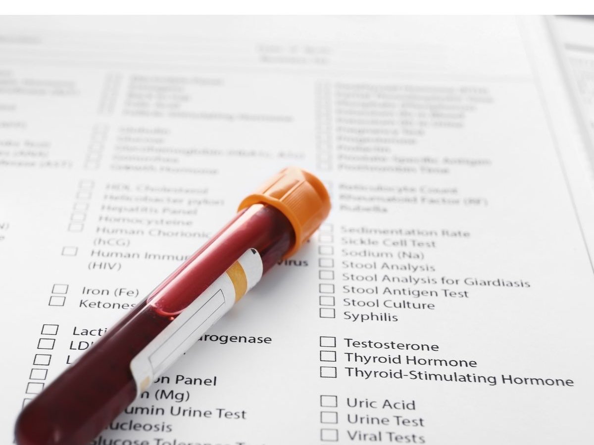 Blood sample vial on a biomarker test-order sheet